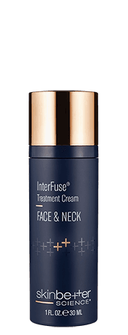 InterFuse® Treatment Cream
