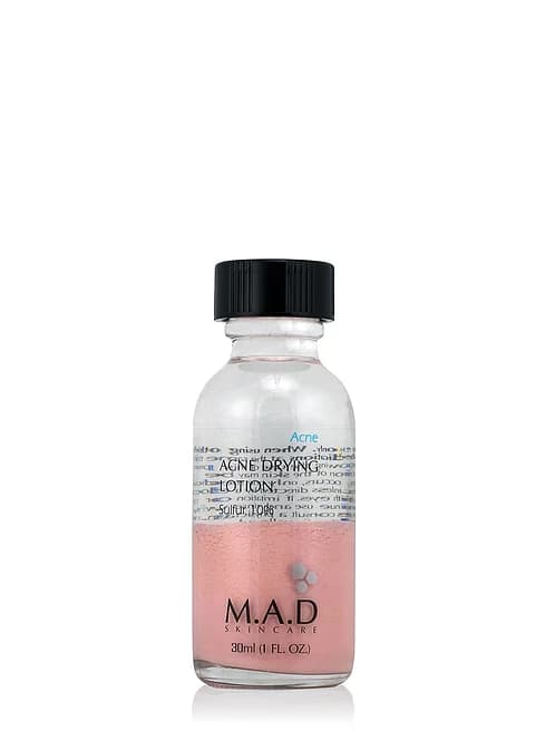 Acne Drying Lotion Sulfur 10%